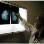 Abortion causes 10,000 cases of breast cancer annually in the US