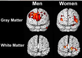 American women, all women, have different brain structures than men
